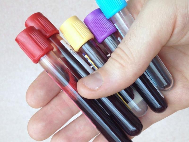 Лабораторные вакуумные пробирки для забора крови